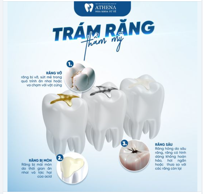 Răng vỡ lại lành nhờ phương pháp trám răng thẩm mỹ