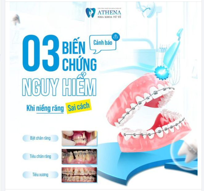Cảnh báo 3 biến chứng nguy hiểm khi niềng răng sai cách