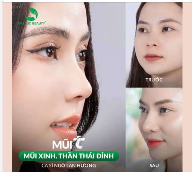 Thu Cúc Hô biến mũi tẹt kém sang thành dáng mũi S-line sang chảnh 
