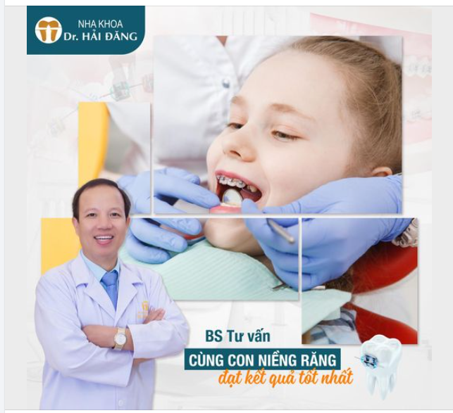 LẮNG NGHE BÁC SĨ TƯ VẤN ĐỂ CON NIỀNG RĂNG ĐẠT KẾT QUẢ TỐT NHẤT