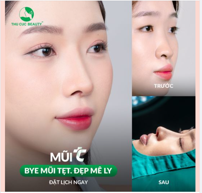 Thật tuyệt vời khi không còn lo lắng về dáng mũi thấp Lựa chọn Mũi TC