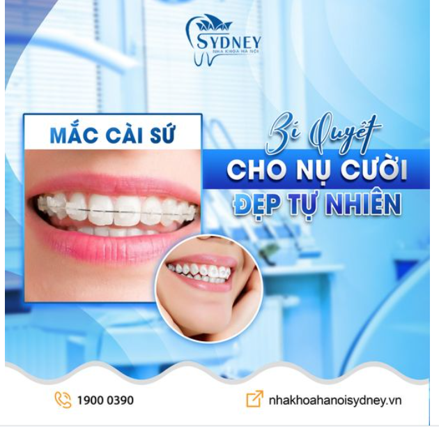 MẮC CÀI SỨ - BÍ QUYẾT CHO NỤ CƯỜI ĐẸP TỰ NHIÊN