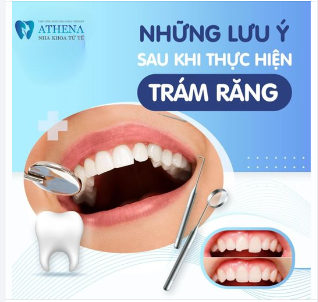 Những lưu ý sau khi trám răng
