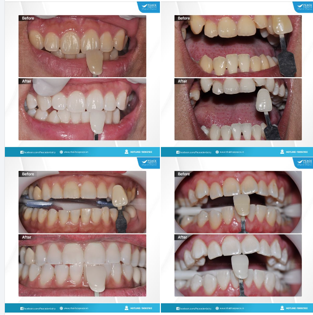 KHỞI ĐỘNG TUẦN MỚI BẰNG NỤ CƯỜI TRẮNG SÁNG
