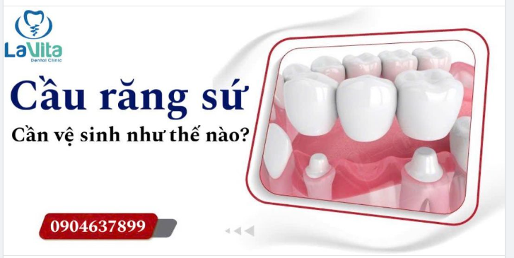 CÁCH VỆ SINH CẦU RĂNG SỨ GIÚP RĂNG CHẮC KHOẺ LÂU DÀI