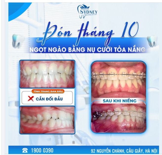 ĐÓN THÁNG 10 NGỌT NGÀO BẰNG NỤ CƯỜI TỎA NẮNG