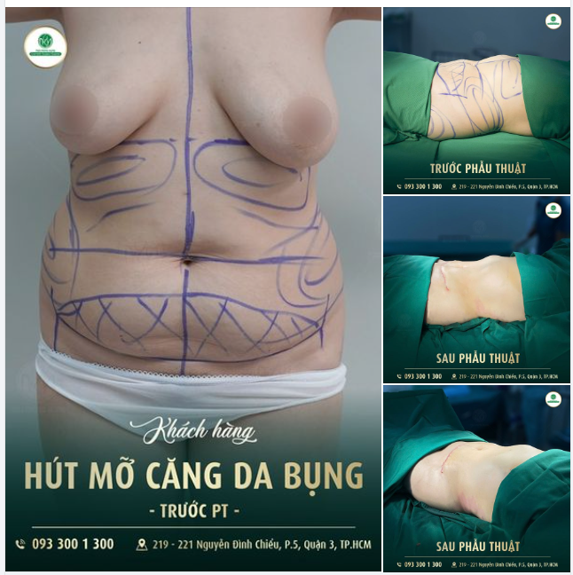 VÓC DÁNG CỦA NÀNG ĐANG GẶP PHẢI TÌNH TRẠNG