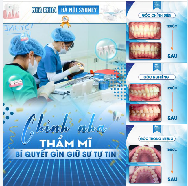 CHỈNH NHA THẨM MỸ - BÍ QUYẾT GÌN GIỮ SỰ TỰ TIN