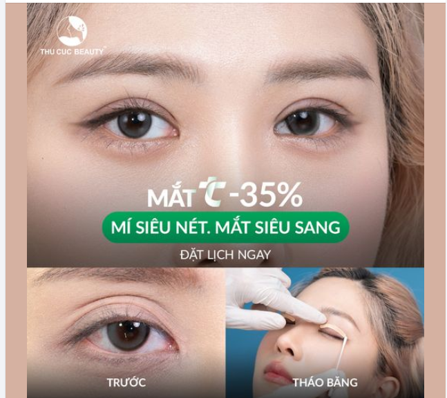 Giải pháp loại bỏ đa nếp mí của KH Thảo Nguyễn Chọn Mắt TC