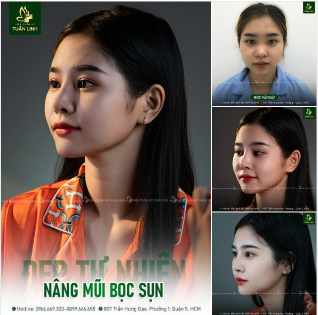 Tại sao nói đây là Thời điểm vàng làm mũi ăn TẾT!!
