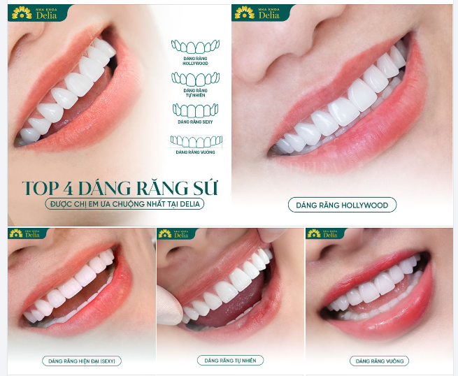 Điểm danh những DÁNG RĂNG SỨ ĐƯỢC ƯA CHUỘNG NHẤT TẠI DELIA