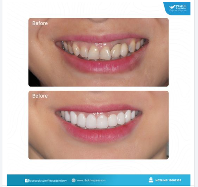 THAY ĐỔI DIỆN MẠO TỰ NHIÊN, VẪN LÀ CHÍNH MÌNH NHƯNG ĐẸP VÀ THU HÚT HƠN