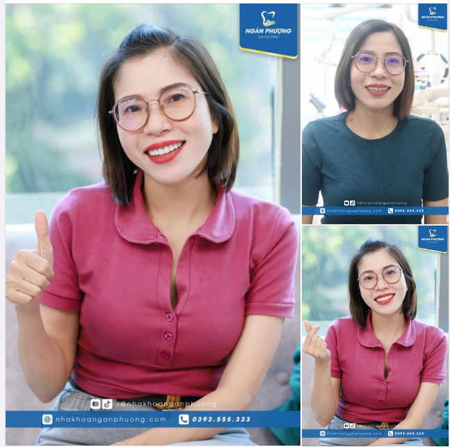 Đổi màu răng sứ, đổi nụ cười sáng đẹp như mơ