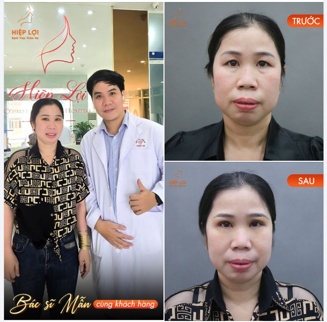 Khách hàng tái khám cùng BS Mẫn