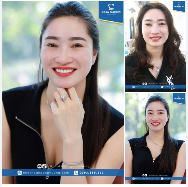 Nếu ai hỏi nha khoa, định nghĩa về sáng bừng là như thế nào