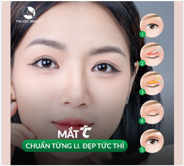 Mí lót làm gương mặt thiếu điểm nhấn. Hô biến nếp mí sắc nét, mắt to tròn chuẩn nàng thơ nhờ Mắt TC