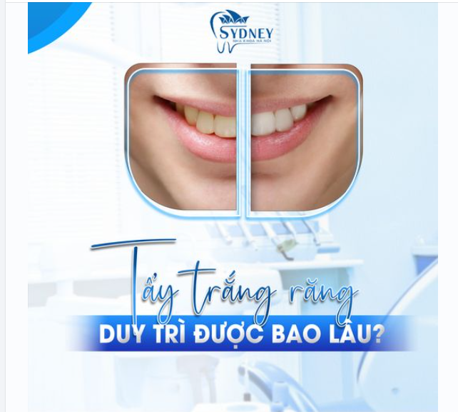 TẨY TRẮNG RĂNG DUY TRÌ ĐƯỢC BAO LÂU?