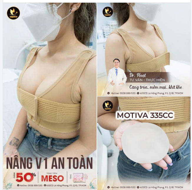 Vòng 1 căng tròn, mềm mại, quyến rũ BẠN CÓ MUỐN?