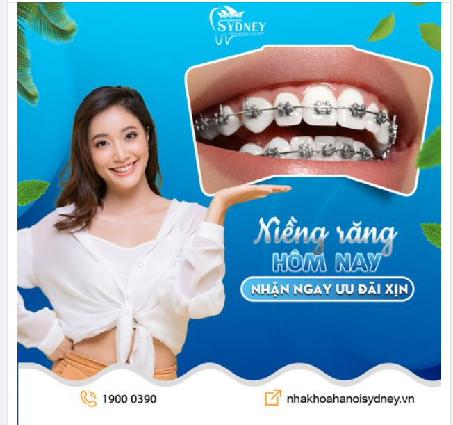 NIỀNG RĂNG HÔM NAY - NHẬN NGAY ƯU ĐÃI XỊN