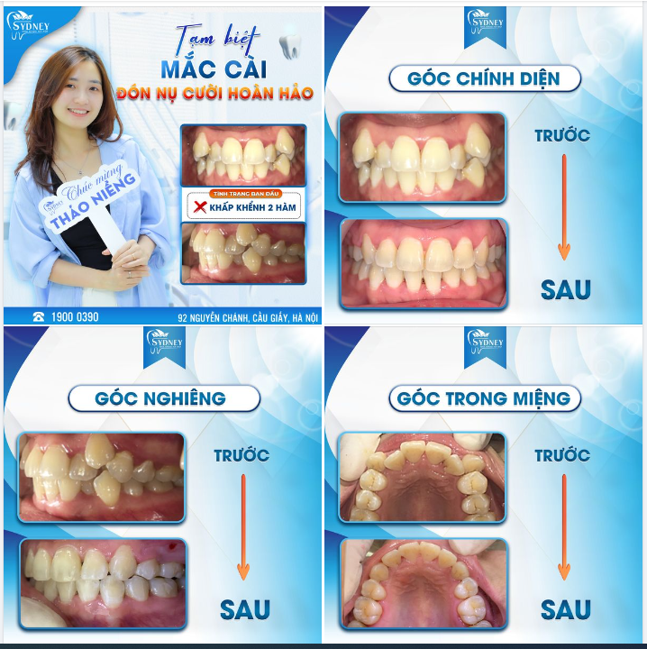TẠM BIỆT MẮC CÀI - ĐÓN NỤ CƯỜI HOÀN HẢO