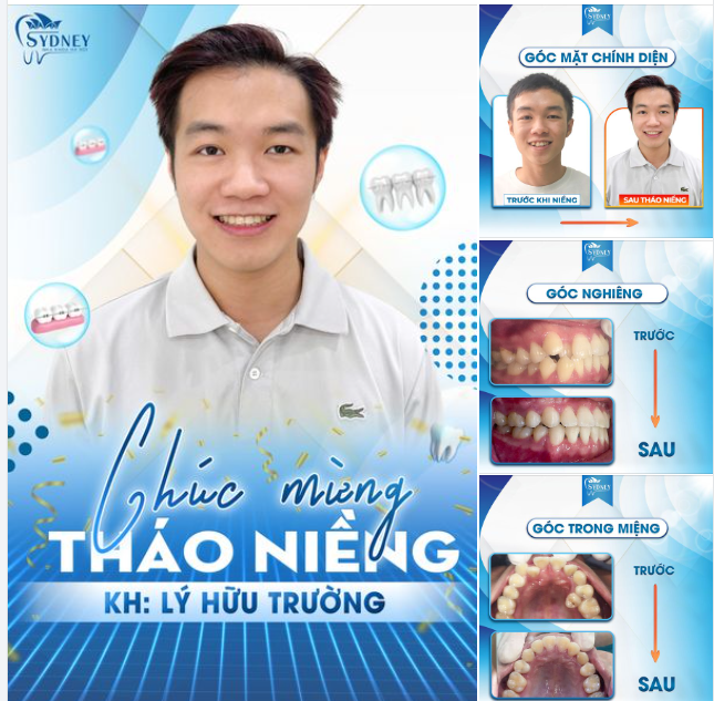 CHÚC MỪNG THÁO NIỀNG KH. HỮU TRƯỜNG