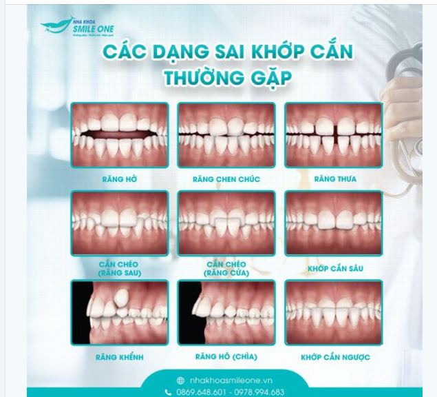RĂNG BẠN CÓ ĐANG CHUẨN KHỚP CẮN KHÔNG?