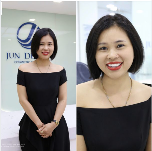 Đổi màu răng sứ, đổi nụ cười sáng đẹp như mơ