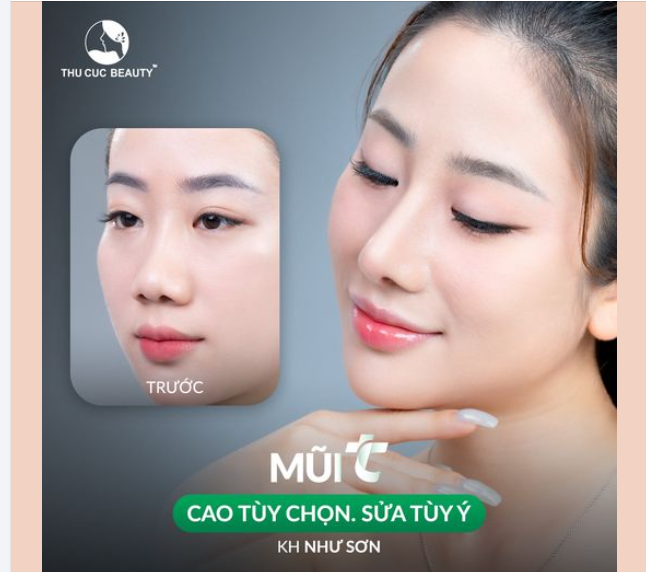 Khách hàng cảm thấy rất tự tin với chiếc mũi cao bay này