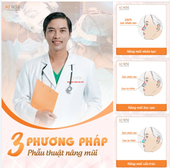 3 phương pháp nâng mũi an toàn và hiệu quả