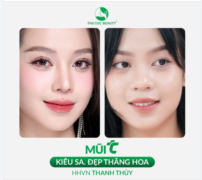 Sở hữu dáng mũi S-line mềm mại như Hoa hậu Việt Nam Thanh Thủy