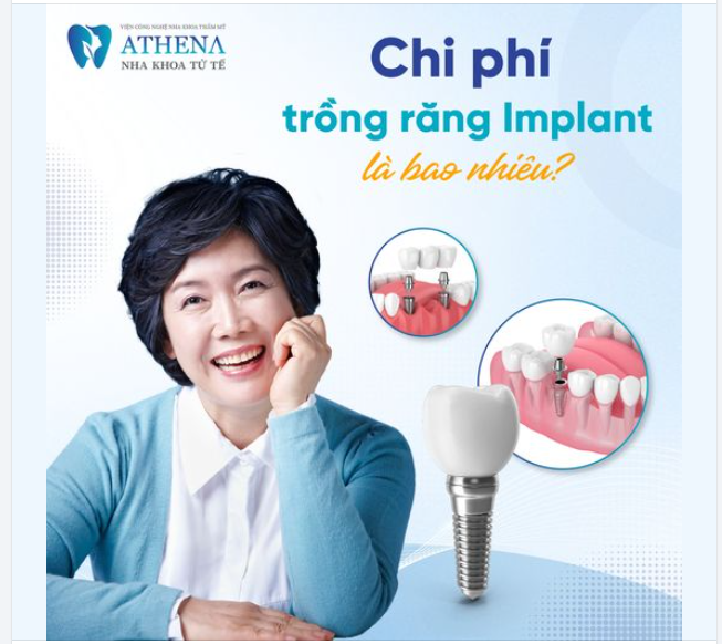 Chi phí trồng răng Implant là bao nhiêu?