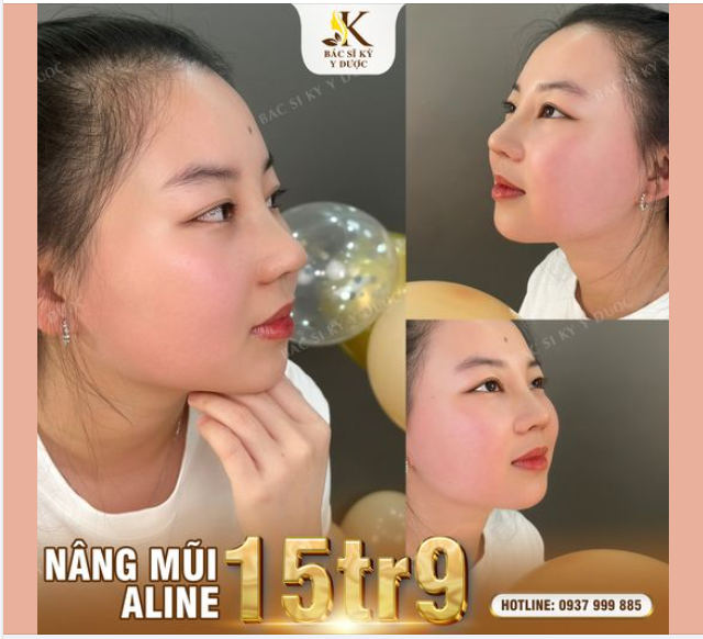 Góc nghiêng, góc thẳng, góc nào cũng xinh nhờ NÂNG MŨI ALINE