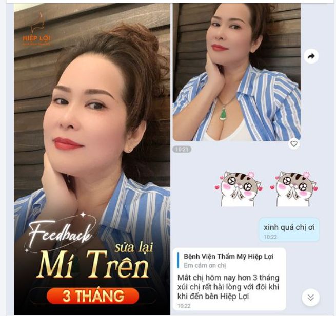 Feedback từ khách hàng - MÍ ĐẸP SAU 3 THÁNG nhà Hiệp Lợi