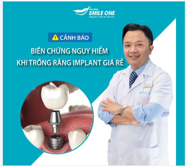 CẢNH BÁO BIẾN CHỨNG NGUY HIỂM KHI TRỒNG RĂNG IMPLANT GIÁ RẺ