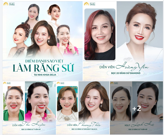 ĐIỂM DANH SAO VIỆT LÀM RĂNG SỨ TẠI NHA KHOA DELIA