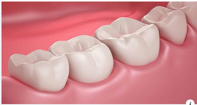 Trám Răng Có Cần Chích Thuốc Tê Không?
