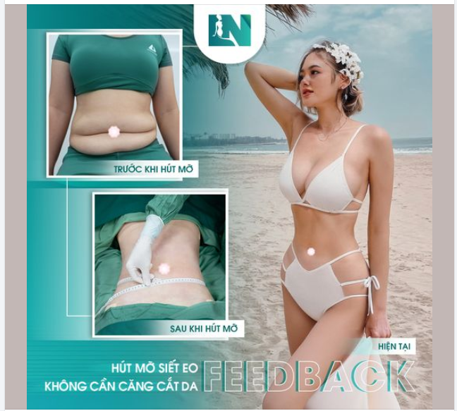 TIẾP TỤC SERIES KHOE ẢNH BODY
