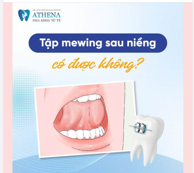 Tập Mewing sau khi niềng có được không?