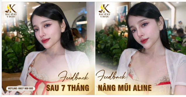 CHUYÊN MỤC FEEDBACK MŨI XINH