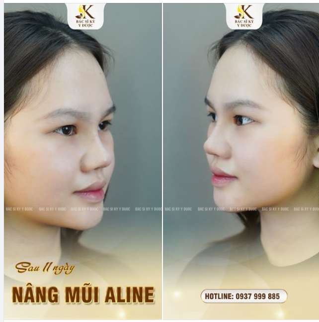CHÀO THÁNG 10 - NGẬP TRÀN ƯU ĐÃI Cơ hội "VÀNG" để sở hữu nhan sắc mơ ước với giá ưu đãi "CHƯA TỪNG CÓ".