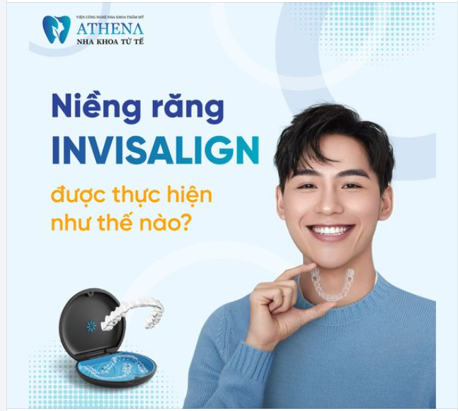 Niềng răng Invisalign là phương pháp chỉnh nha tiên tiến sử dụng khay trong suốt, mang lại hiệu quả vượt trội và thẩm mỹ cao.