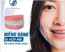 NIỀNG RĂNG BỊ HÓP MÁ VÀ CÁCH KHẮC PHỤC