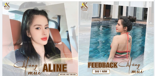 CHUYÊN MỤC FEEDBACK TỪ KHÁCH HÀNG MŨI XINH GIÁ 15,9TR DUY NHẤT TRONG THÁNG 10.2024