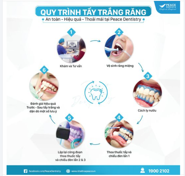 QUY TRÌNH TẨY TRẮNG RĂNG AN TOÀN - HIỆU QUẢ TẠI PEACE DENTISTRY