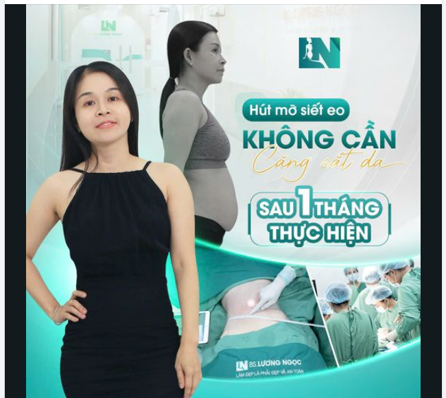 Tập luyện cả năm không bằng 1 giờ hút mỡ siết eo