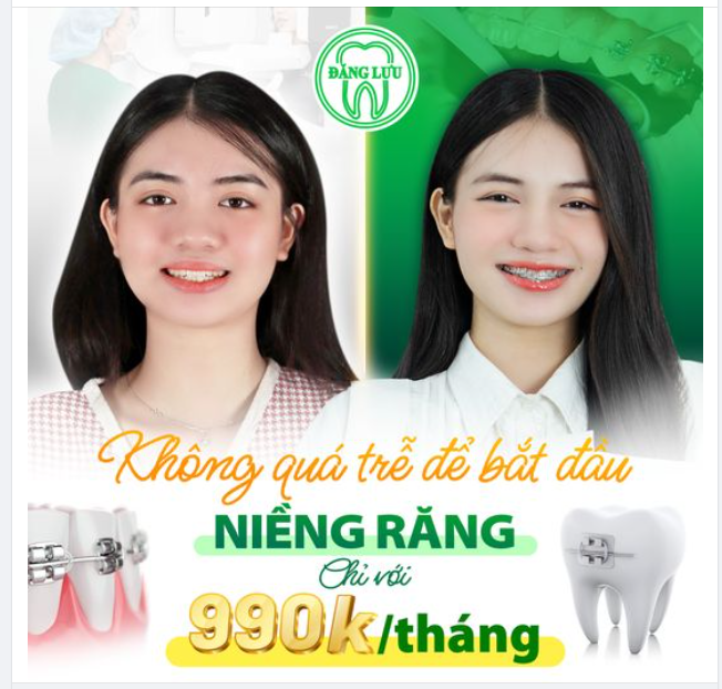 Yêu Thương Bản Thân Chưa Bao Giờ Là Muộn Màng,. Và... Không Bao Giờ Quá Trễ Để Bạn Bắt Đầu Hành Trình Niềng Răng & Trở Nên Tự Tin Hơn