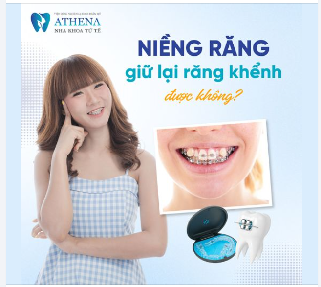 Có giữ được răng khểnh khi niềng răng