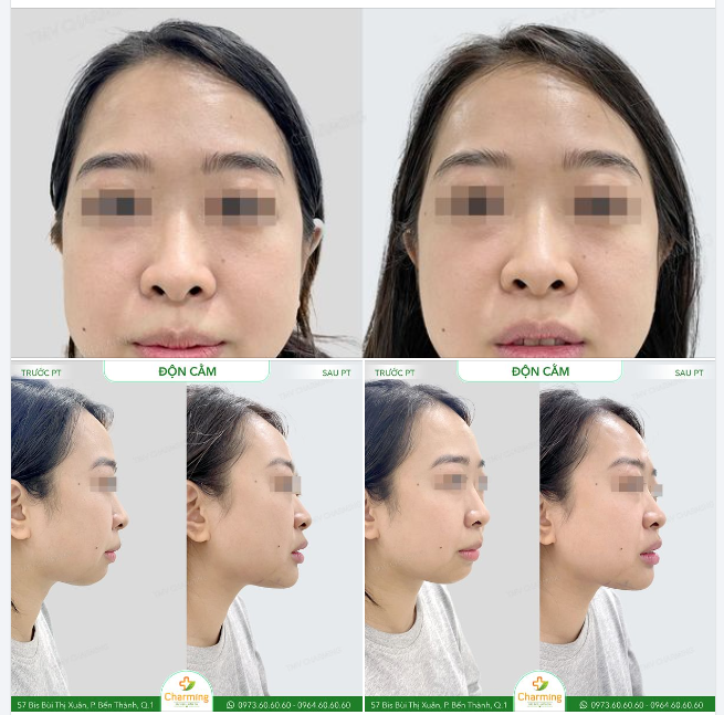 Nhìn một lần thôi là thấy sự thay đổi khác biệt ngay đó nha
