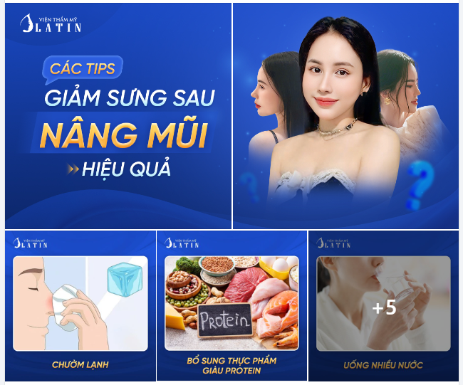 CÁC TIPS GIẢM SƯNG SAU NÂNG MŨI HIỆU QUẢ