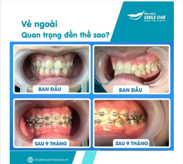VẺ BỀ NGOÀI QUAN TRỌNG ĐẾN THẾ SAO?